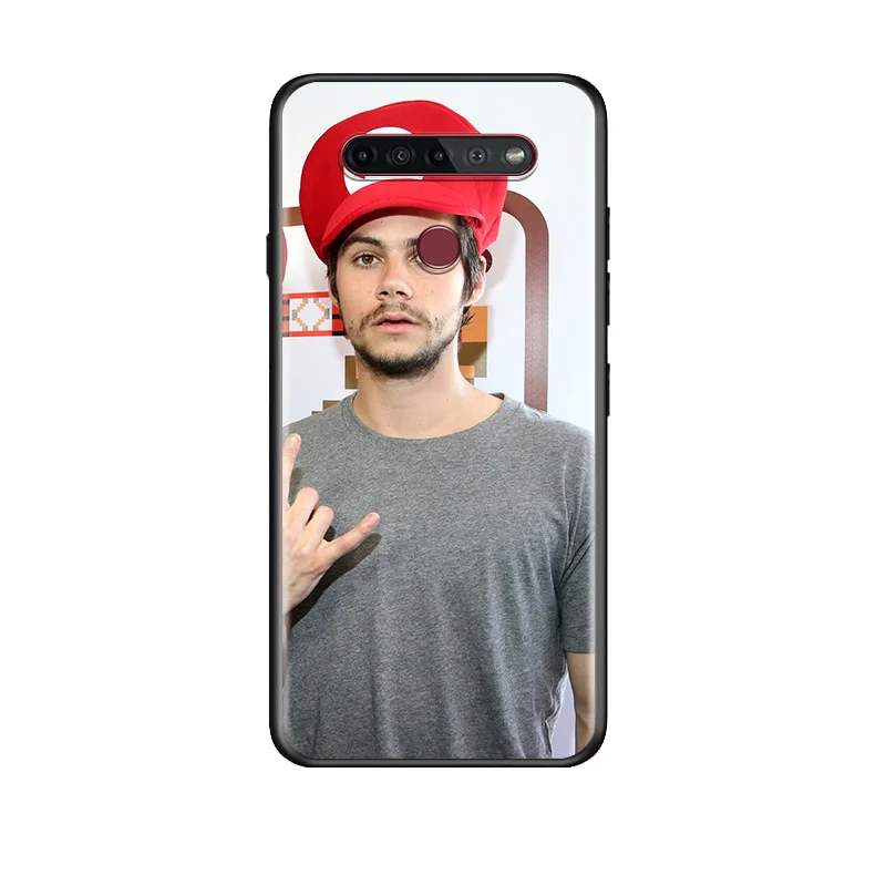 

Teen Wolf Dylan Obrien For LG G8 V30 V35 V40 V50 V60 Q60 K40S K50S K41S K51S K61 K71 K22 ThinQ 5G TPU Silicone Black Phone Case