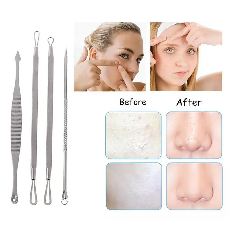 8 шт./компл. уход за кожей лица угорь иглы Пинцет Для Удаления Нержавеющая сталь