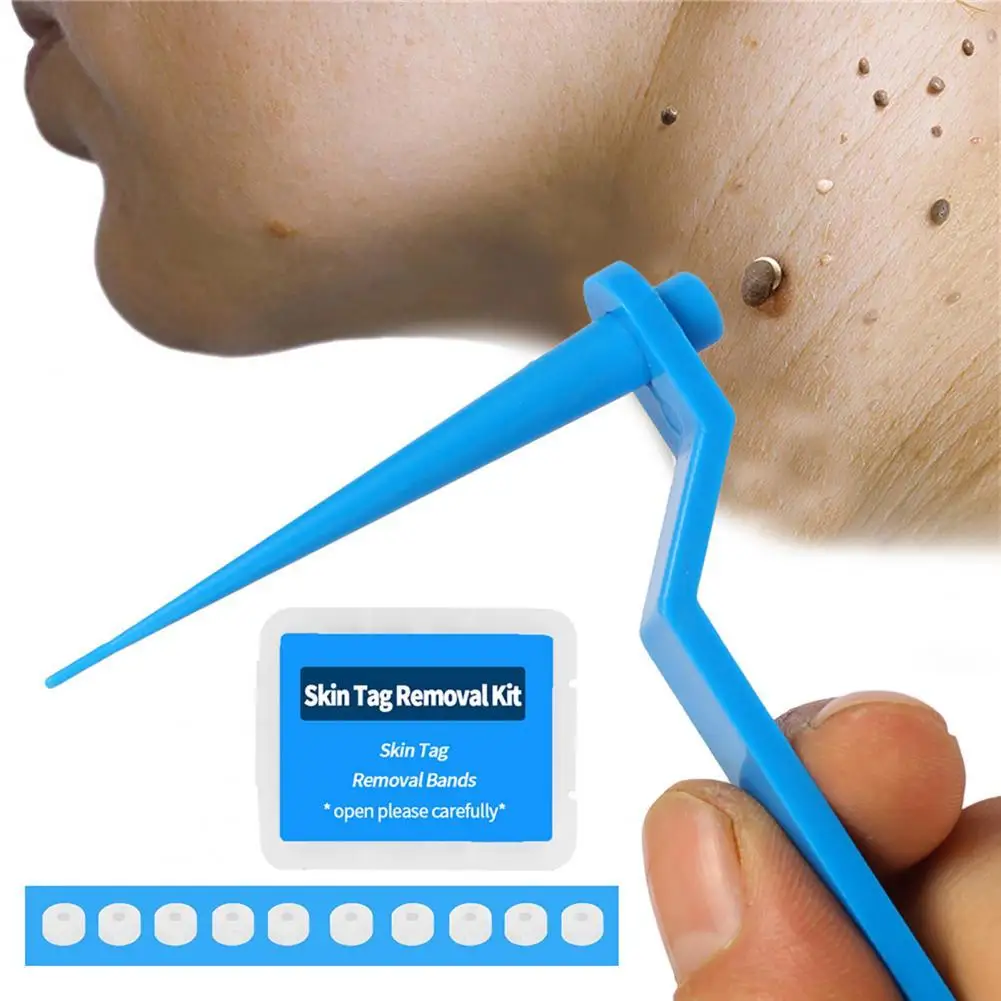 

Medical Skin Tag Kill Skin Mole Wart Remover Micro Band Skin Tag Removal Kit With Cleansing Swabs Adult Mole Wart Face Care