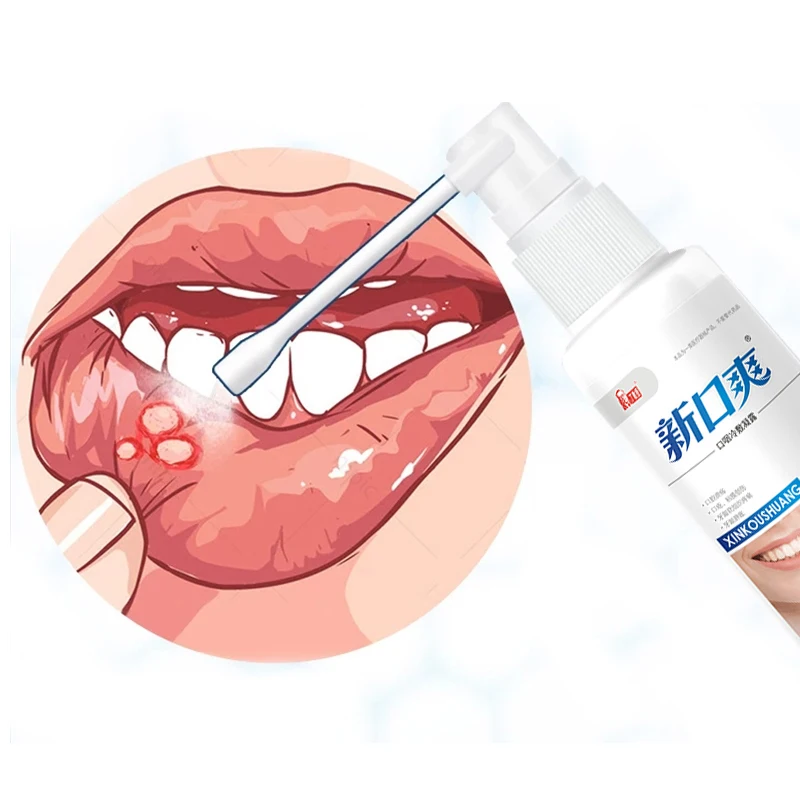 Спрей для полости рта освежающее и охлаждающее средство облегчения боли в горле