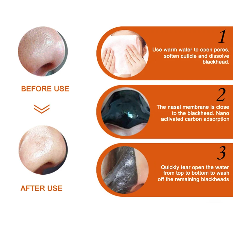 Оптовая продажа черная маска для удаления черных точек Очищающая отшелушивающая