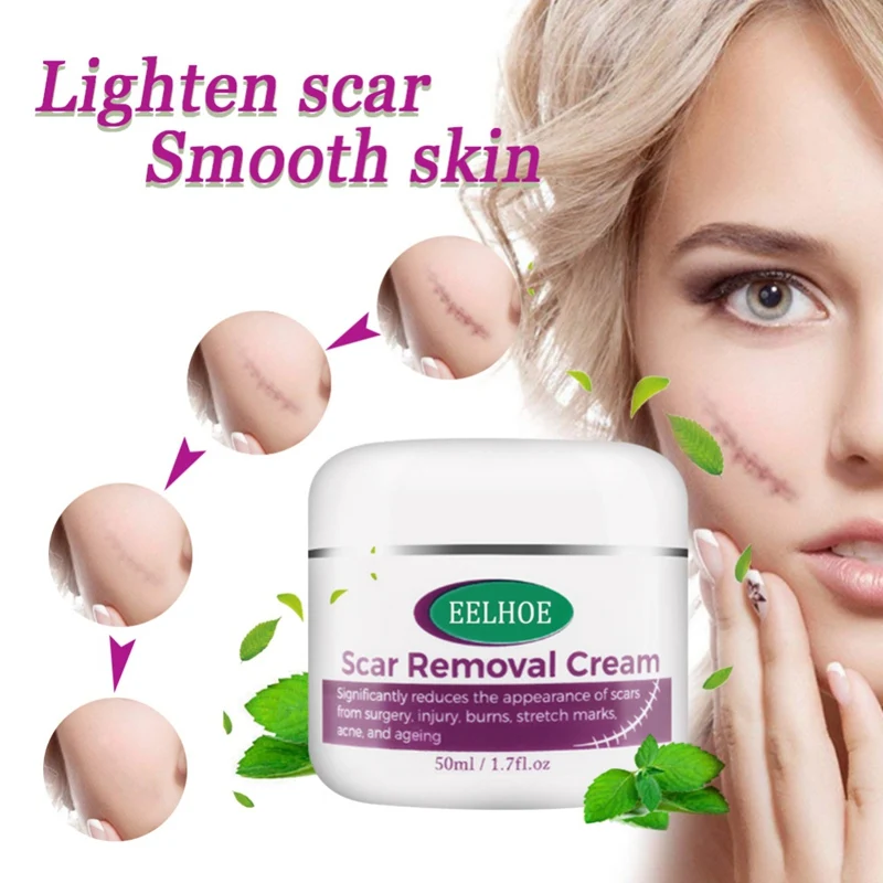 Многоразовый крем для удаления шрамов от угревой сыпи выцветает рубцов лица C