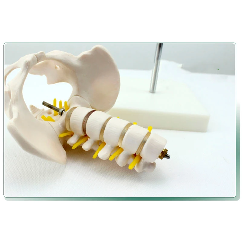 Мини каркас для поясничного интерпозвонков модель из ПВХ пятисекционная скелета