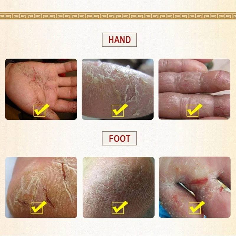 Натуральное змеиное масло крем для ухода за руками анти бактерии против трещин