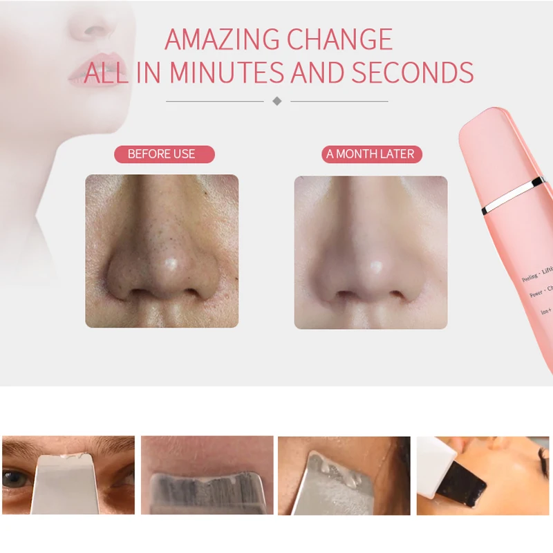 Goede Nohon Ultrasone Scrubber Huidverzorging Ionen Diepe Gezicht Reiniging Schop Peeling Gezicht Lifting Cavitatie Verwijderen Acne Mee-eters