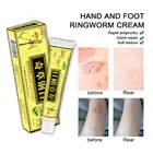 Мазь YIGANERJING QICAOGANGMU для лечения дерматита, экзематоида, крем от псориаза, 10 шт.