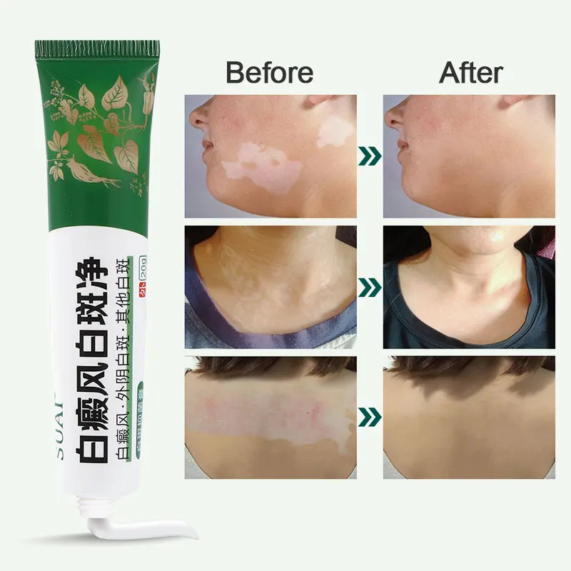 1/2 шт. мазь для восстановления кожи шеи 20 г | Красота и здоровье