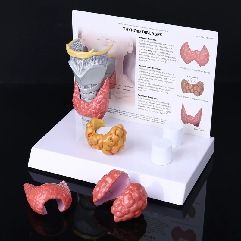 

Модель человеческой анатомической щитовидной железы, патология, анатомия, пищеварительная система, дисплей, обучающий инструмент