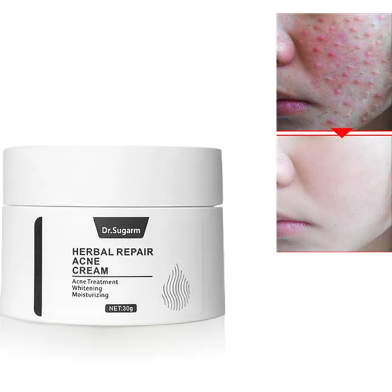 Дневной крем для лица Уход за кожей травяной ремонт лечение от прыщей