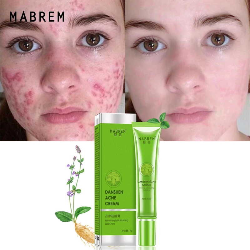 

MABREM Acne Treatment Plant Face Cream Remove Acne Scar Oil Control Shrink Pores Acne Cream Nourish Whitening Skin Care
