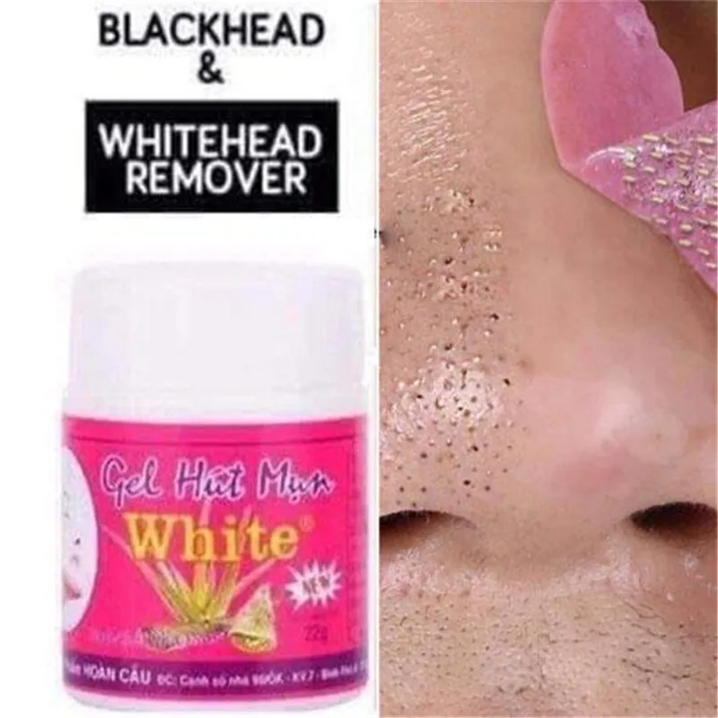 Носа черных точек маска черный крем для удаления гель хижине Mun белый против