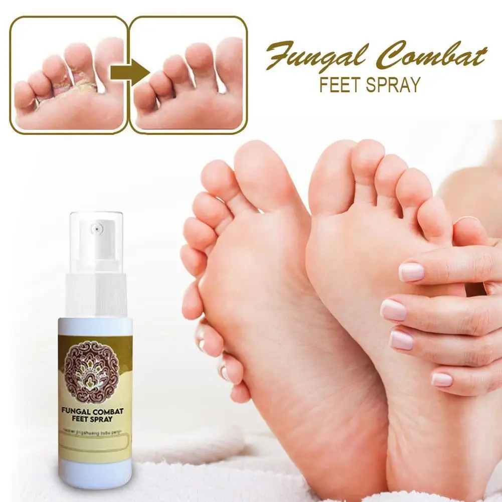 

Anti-fungal Infection Foot Sterilization Spray Disinfection To Relieve Itching Blisters Erosion Itchy Feet Peeling