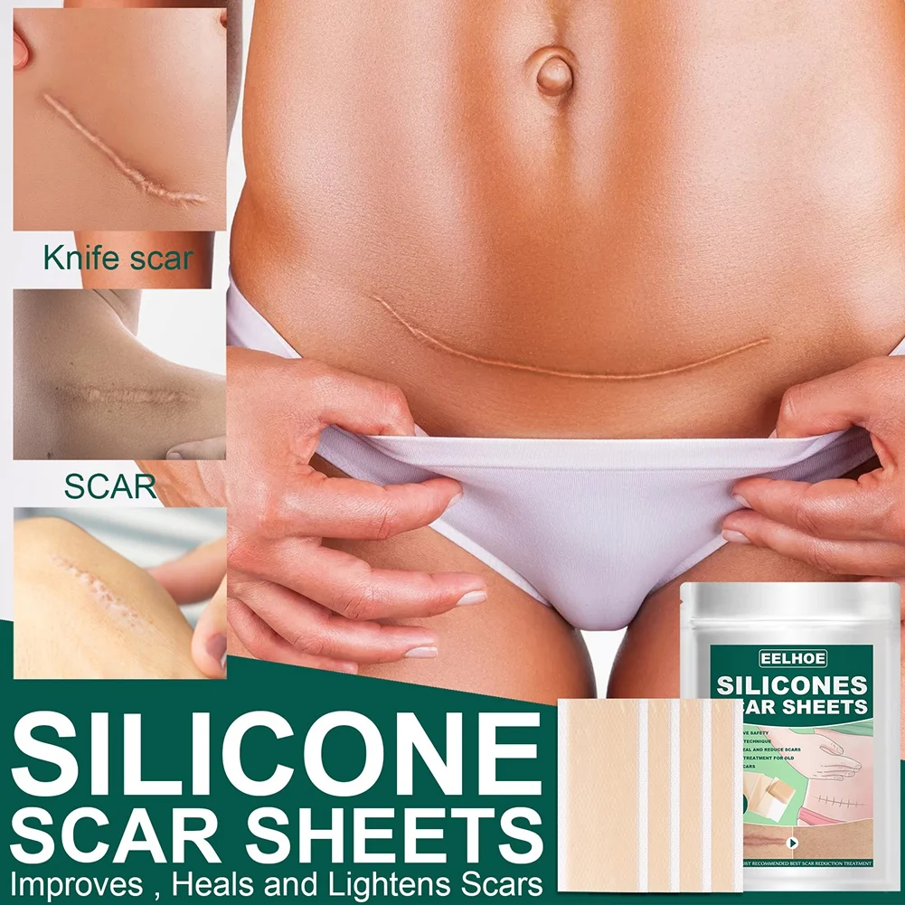 

4Pcs Scar Stickers Pregnancy Hot Scar Transparent Repair Stickers Professional Scar Elimination Scar Removal Patch