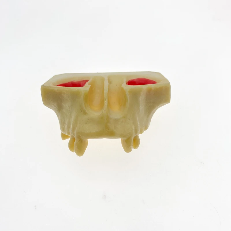 Dental Sinus Lift Practice Teeth Model Typodont Study Model 2013F