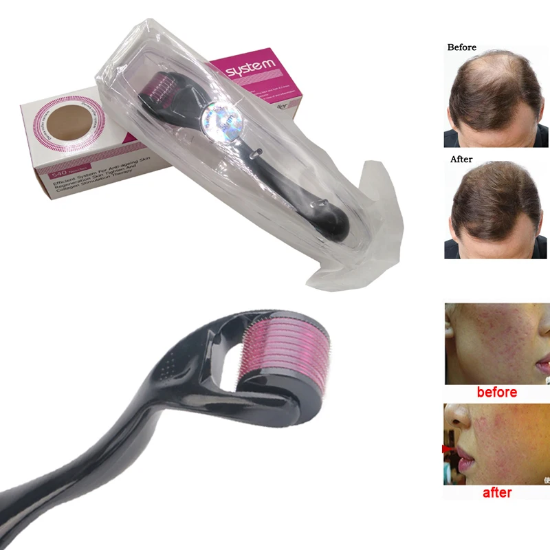 Derma Roller DRS 540 микро игла микроигла для ухода за кожей лечение роста волос бороды