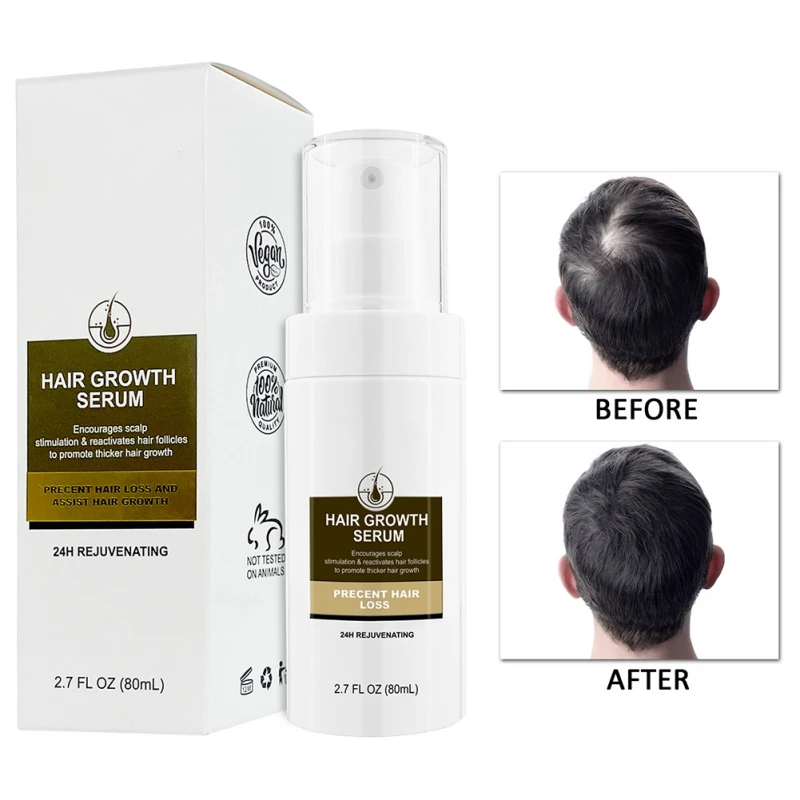 

80ml Herbal Hair Regrowth Serum Natural Thickening Anti Hair Loss Hair Oil Hair Regrowth Treatments Hair Loss for All Hair