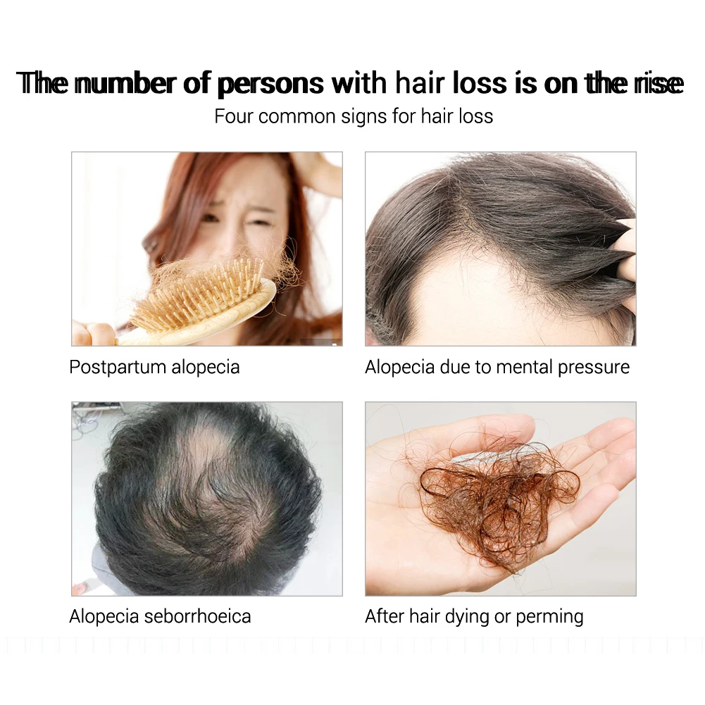 Спрей LANBENA эссенция для быстрого роста волос предотвращающий питание корней