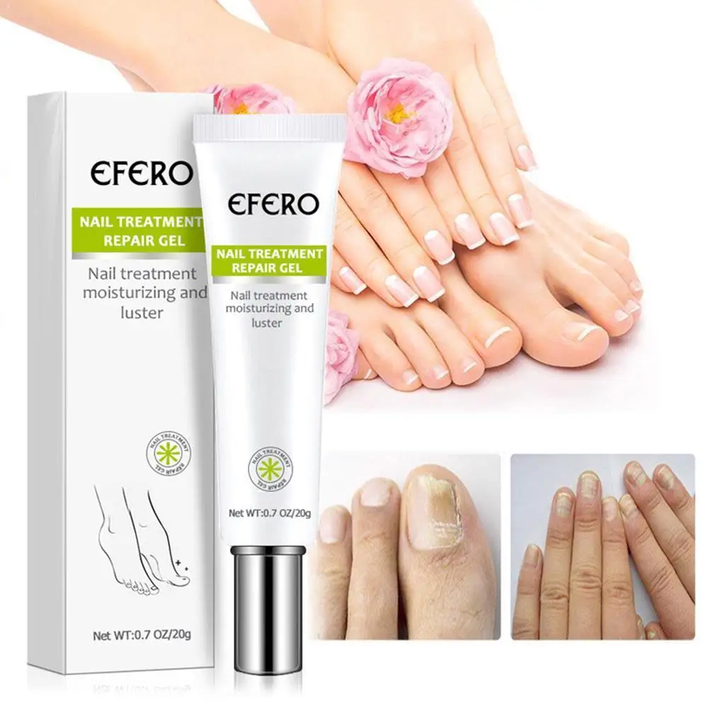 

20g Nail Repair Cream Oil Fungus Treatment Solution Anti Toe Foot Nail Removal Infection Cream Feet Care Protector Fungal Cutic