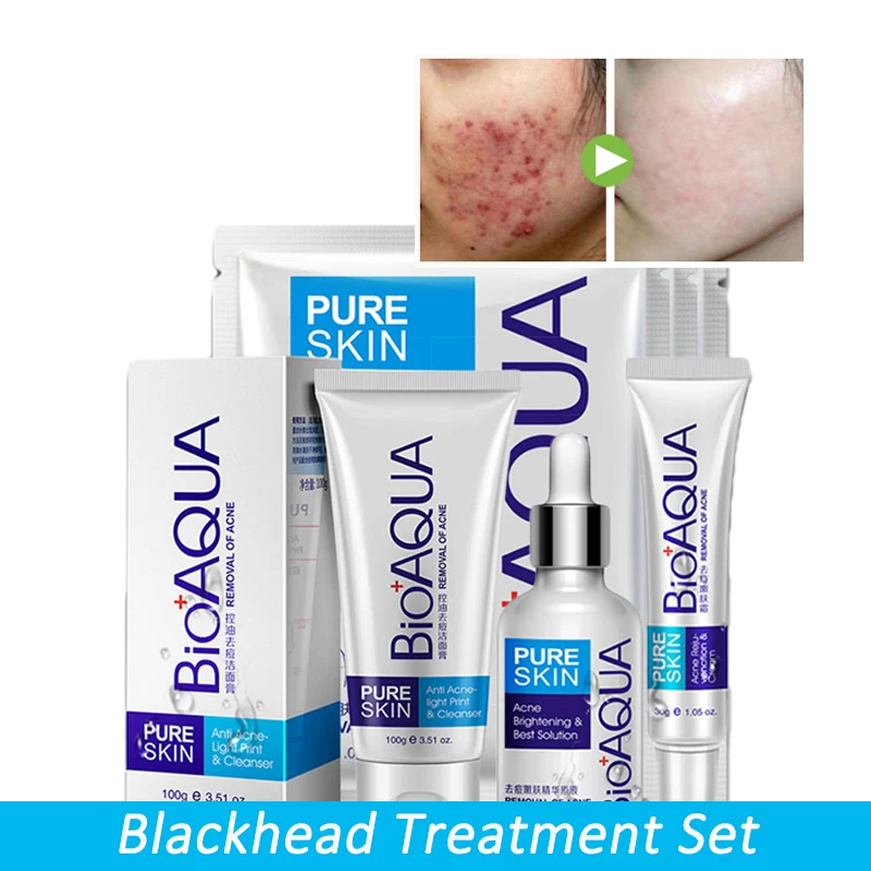 

Anti Acne Shrink Pores Whitening Treatment Blackhead Scars Anti Acne Removal Gel Moisturizing Scar Face Care Set 4 pcs