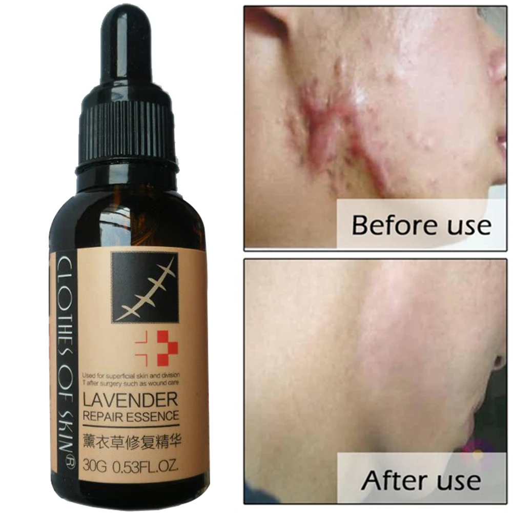 Лечение гладкой кожи восстановление эссенция для ухода за кожей лаванда дезальт