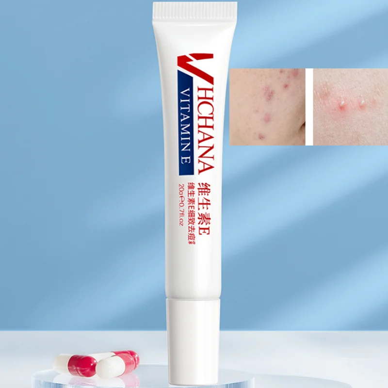 

Vitamin E Refining Acne Cream Balancing Water and Oil Thorns Removing Acne Fine Pores Oil Control Moisturizing Facial Skin Care