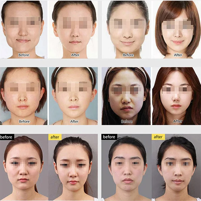 Новинка 2019 инструменты для подтяжки лица тонкая бандажная маска пояс похудения