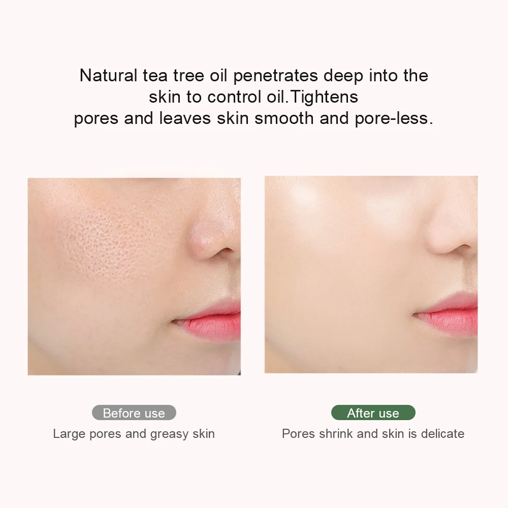 BREYLEE Pore Refining гель для сужения пор уход за кожей лица крем масло Управление