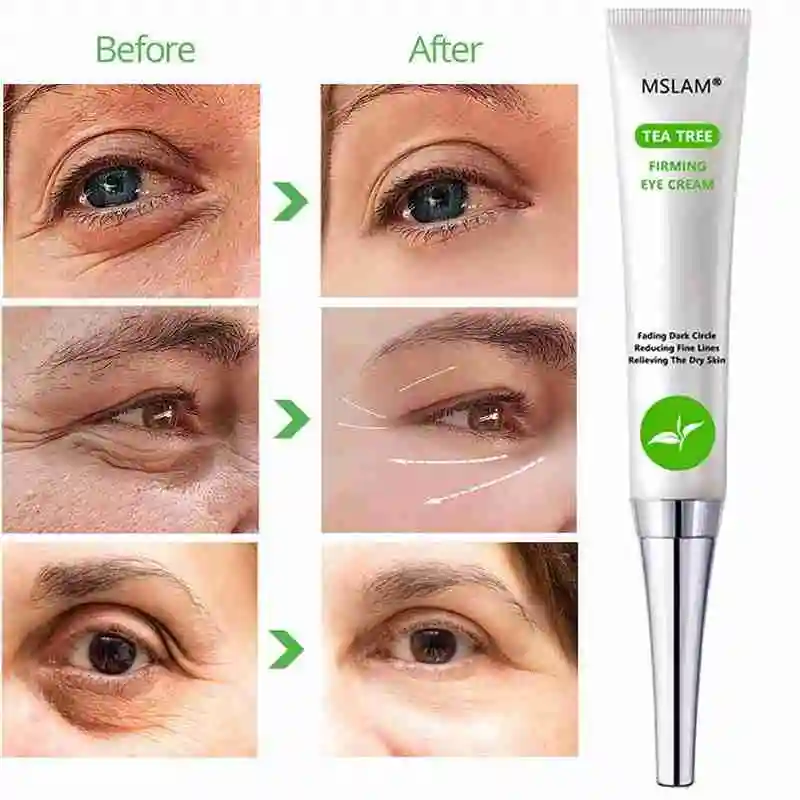 

Tea Tree Eye Cream 20G Anti Anti-Hydrating Dark Circles Skin and Cream Eye For Puffiness Pouch Care Y1A5