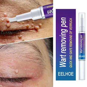 Beauty Health Skin Care Removal Of Warts Liquid Warts Remover Pen Removing Against Moles Anti Verruca Remedy 1