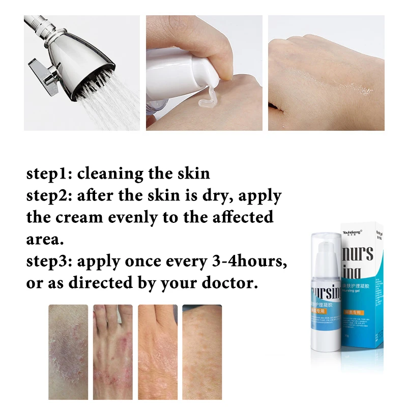Мазь от псориаза Youhekang спрей для ухода за кожей без гормонов зуда экземы|Пластыри