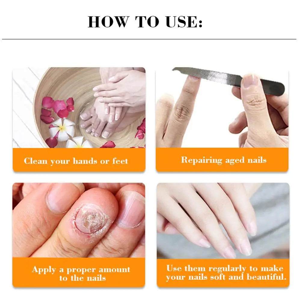 Средство для лечения Ногтей грибок ногтей крем удаления кутикулы масло