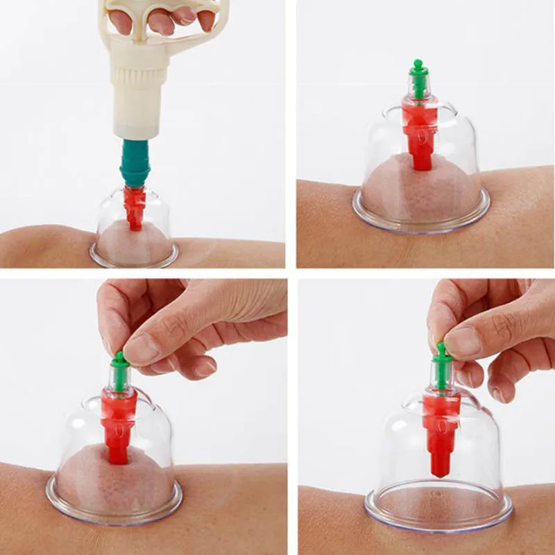 

12pcs Vacuum Cupping Jars For Body Face Massage anti cellulite ventosa Suction Cups Gua Sha Medicine Magnetic Therapy Thick Cans