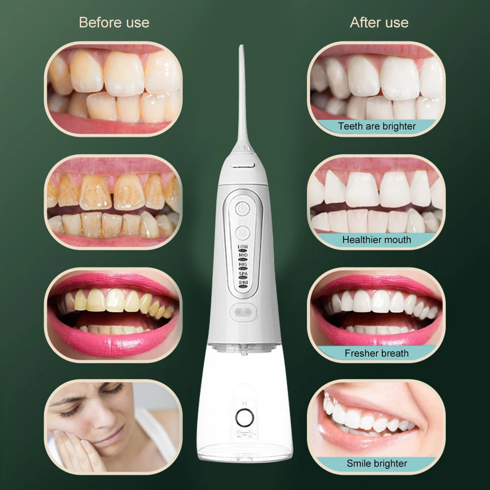 

Portable Household Electric Sonic Dental Scaler Tooth Calculus Remover Stains Tartar Plaque Whitening Tool Oral Cleaner Machine