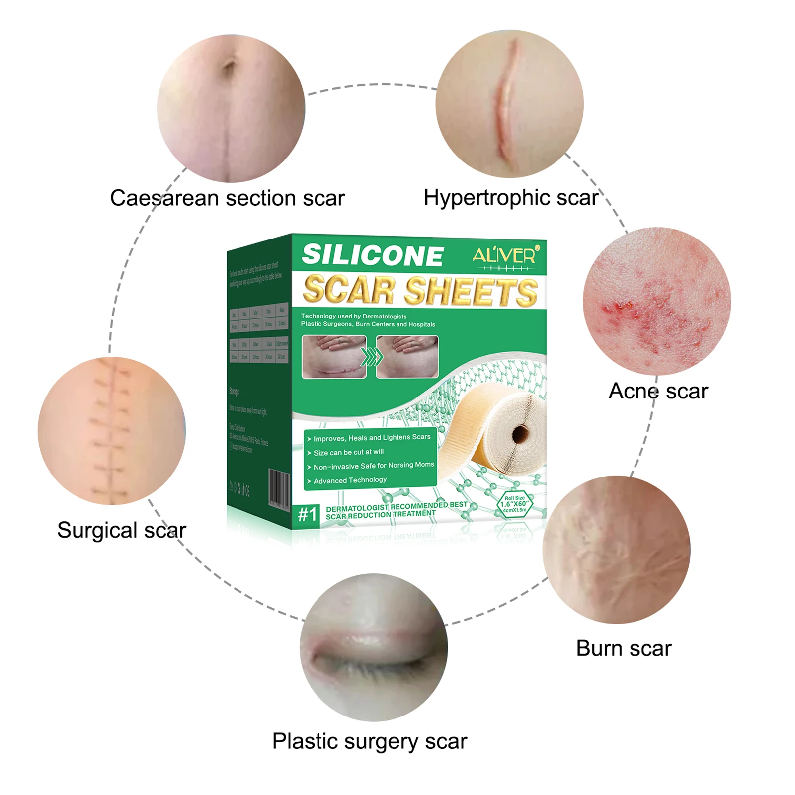 Силиконовые Гелевые полоски ALIVER пластырь силиконовые для шрамов многоразовый