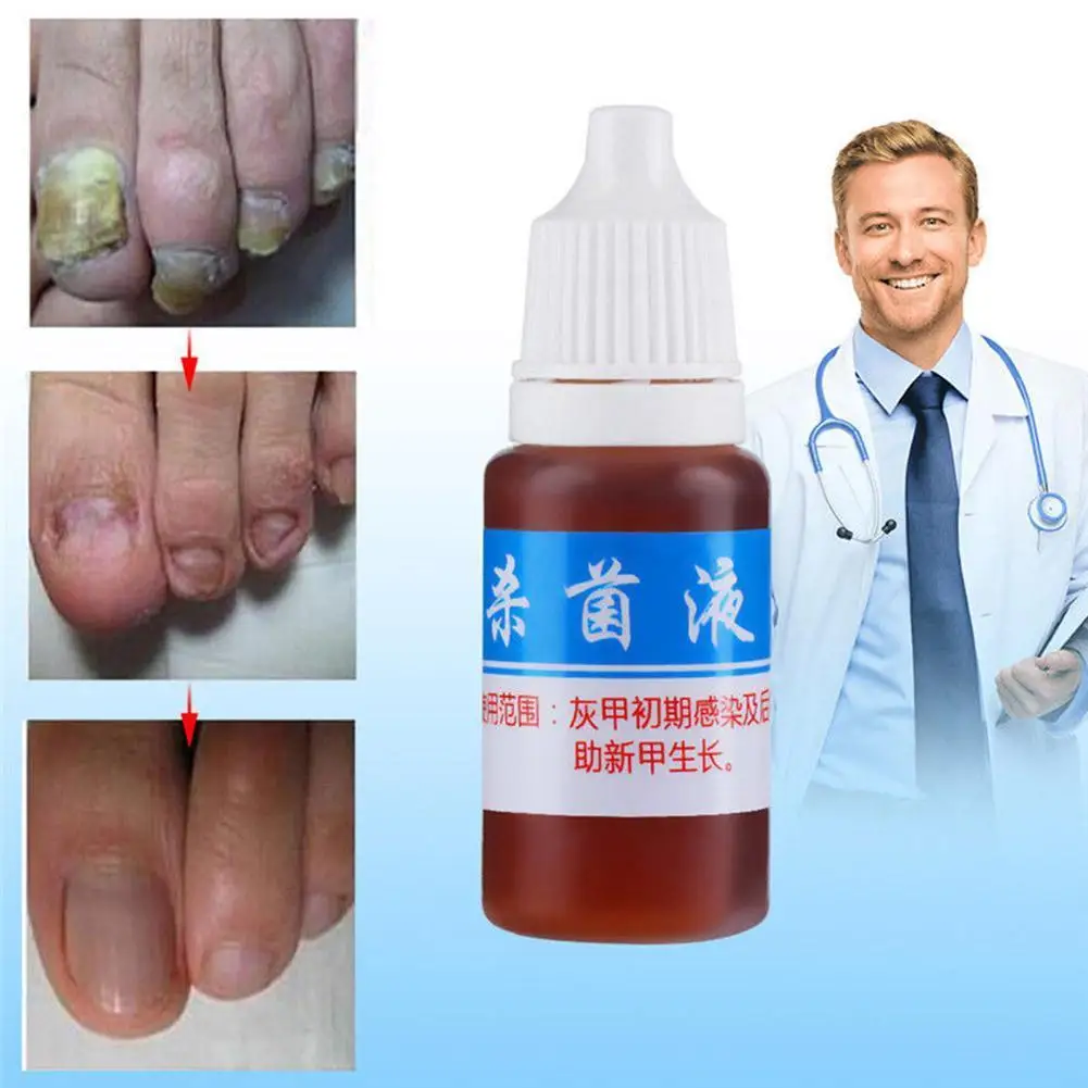 

10ml Health Skin Care Nail Repair Liquid Cleanser Onychomycosis Remover N5R4