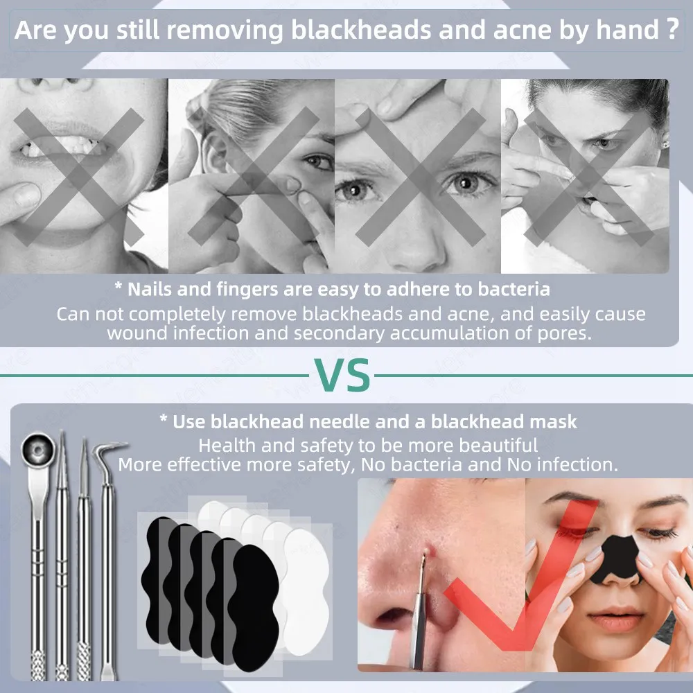 Красота инструмент для удаления чёрных точек уход за кожей Инструменты прыщей