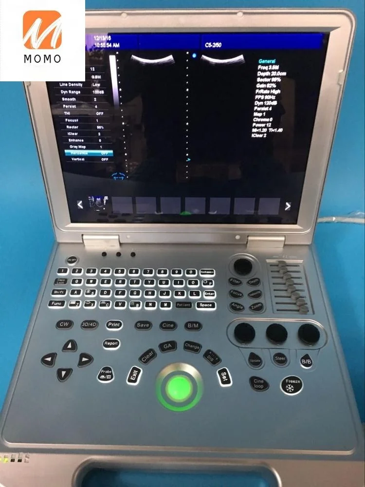 Ультразвуковое качество M5 3D 4D Цветной Допплер ультразвуковой допплер по цене 4d -