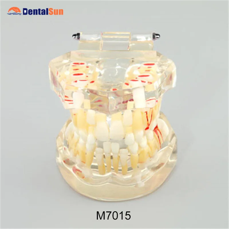 

Dental Pediatric Development Model age 5-9 M7012 Dental Teeth Model