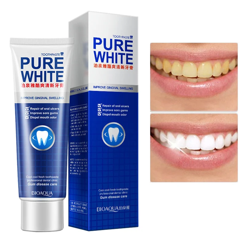 Отбеливающая зубная паста для интенсивного удаления пятен Освежающая Мятная