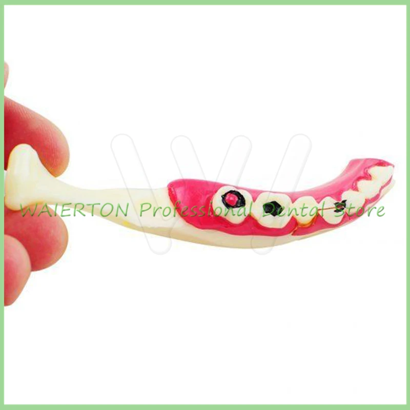 

Dental MandibularTeeth Demonstration Anatomical Patient Study Teach Model