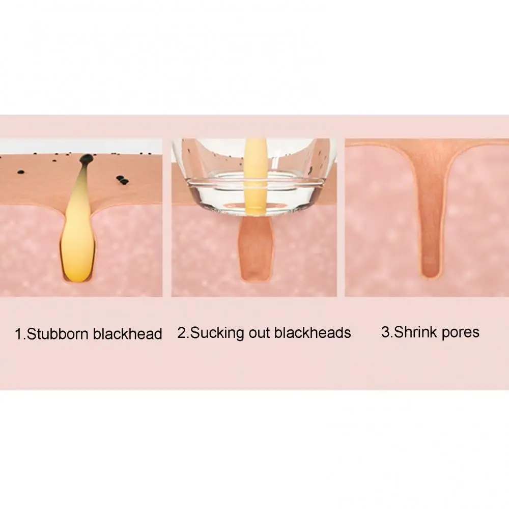 

Blackhead Remover Pore Vacuum Cleaner Face Skin Care Sucker Rechargeable LCD Display Suction Spot Removal Tools Acne Remover
