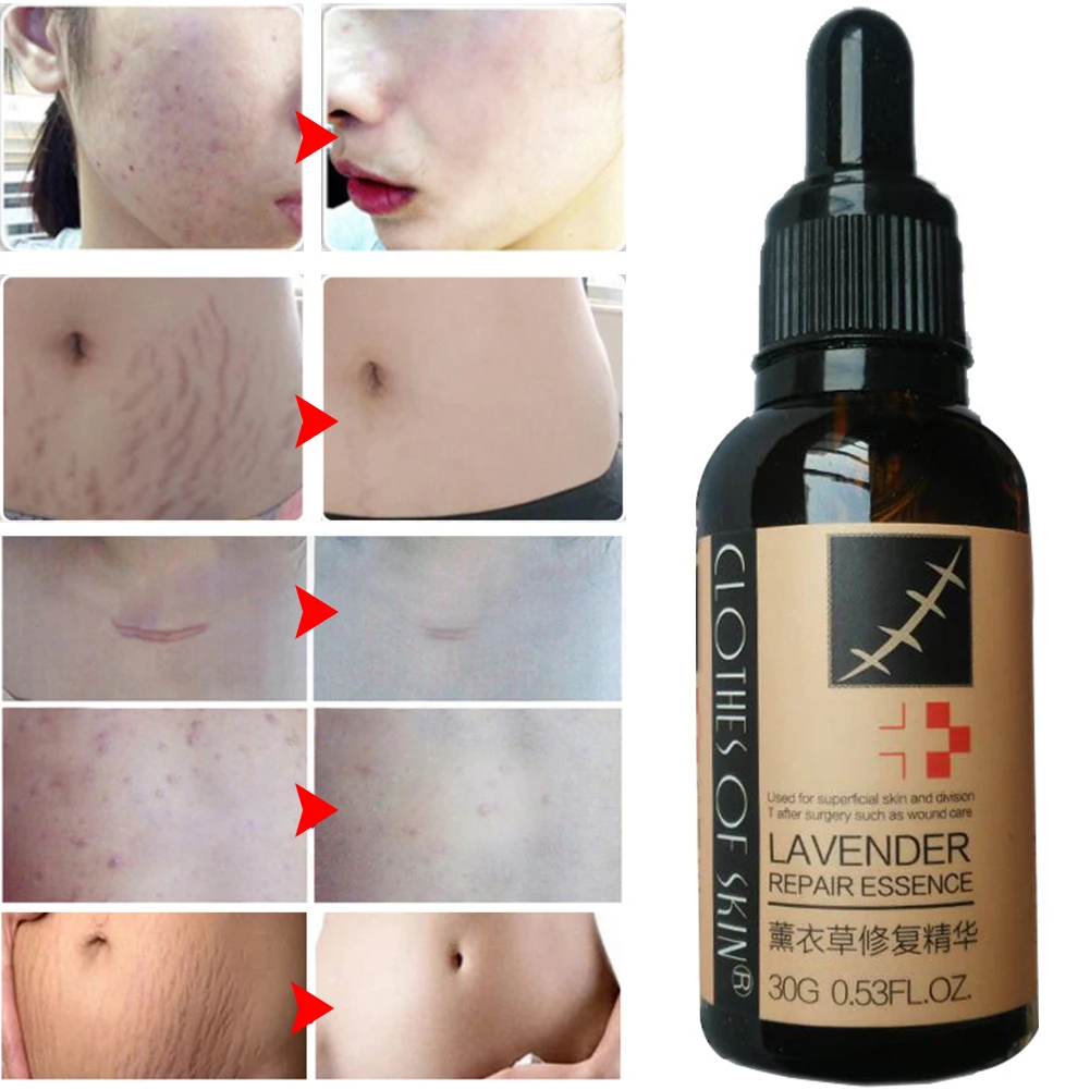 Лечение гладкой кожи восстановление эссенция для ухода за кожей лаванда дезальт