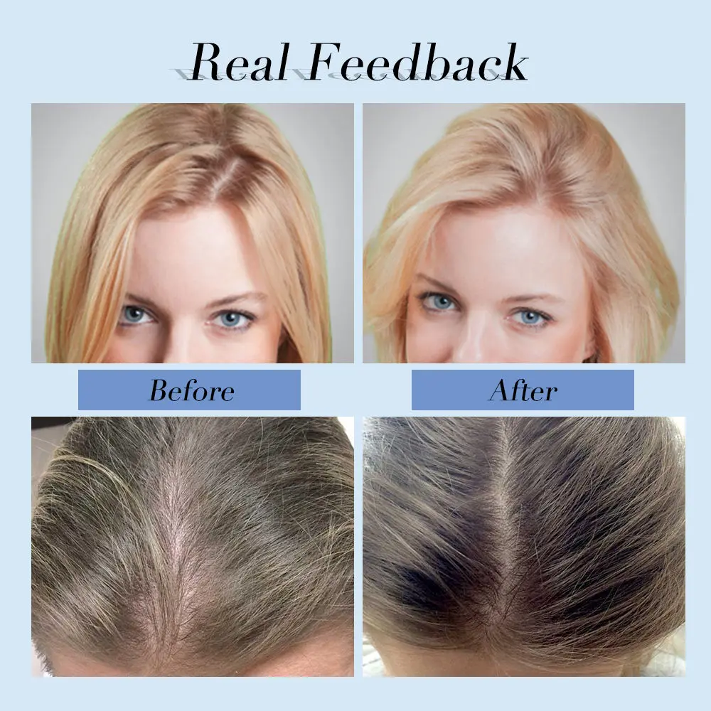 Шампунь против выпадения волос Кератиновое лечение выпадение стимулирует рост