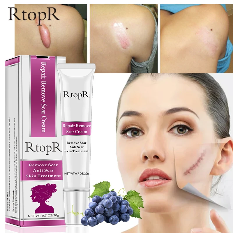 

RtopR Acne Scar Stretch Marks Remover Cream Skin Repair Face Cream Removal Acne Spots Treatment Essence Removal Scar Hyperplasia