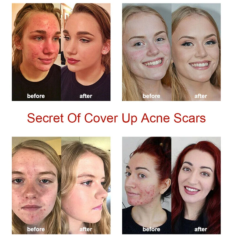 Восстанавливающий консилер крем осветление морщин Косметика стойкий полный