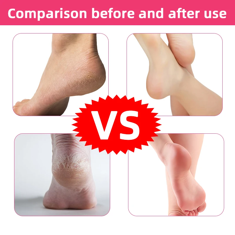 Многофункциональная электрическая шлифовальная машинка для ног устройство