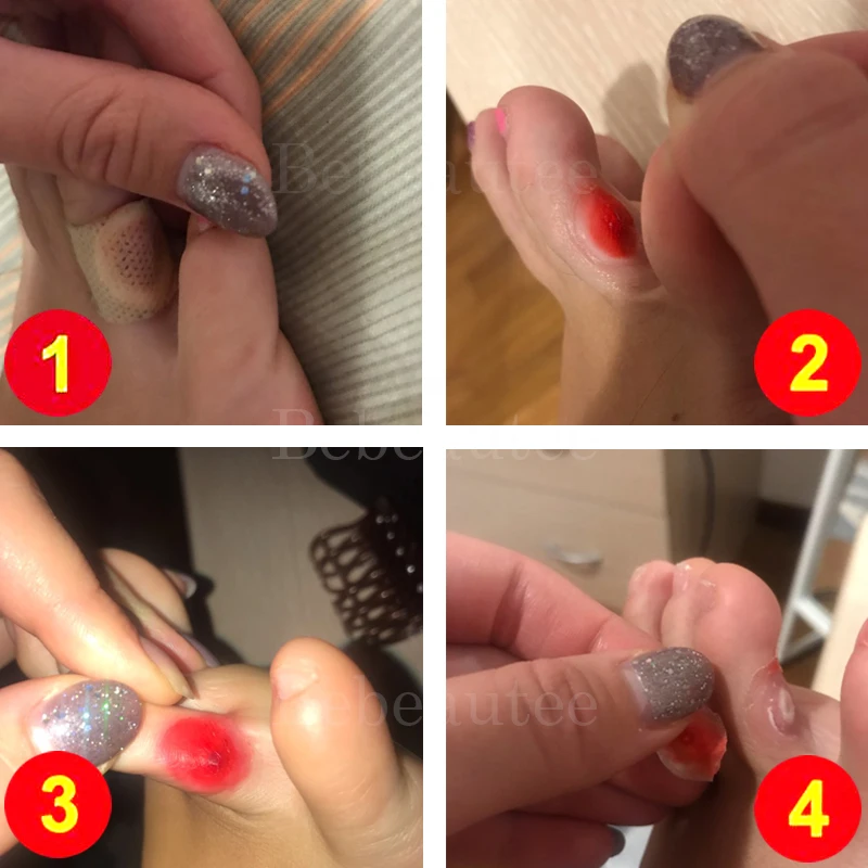 Пластырь кукурузный для ног от мозолей удаление куриных глаз средство против