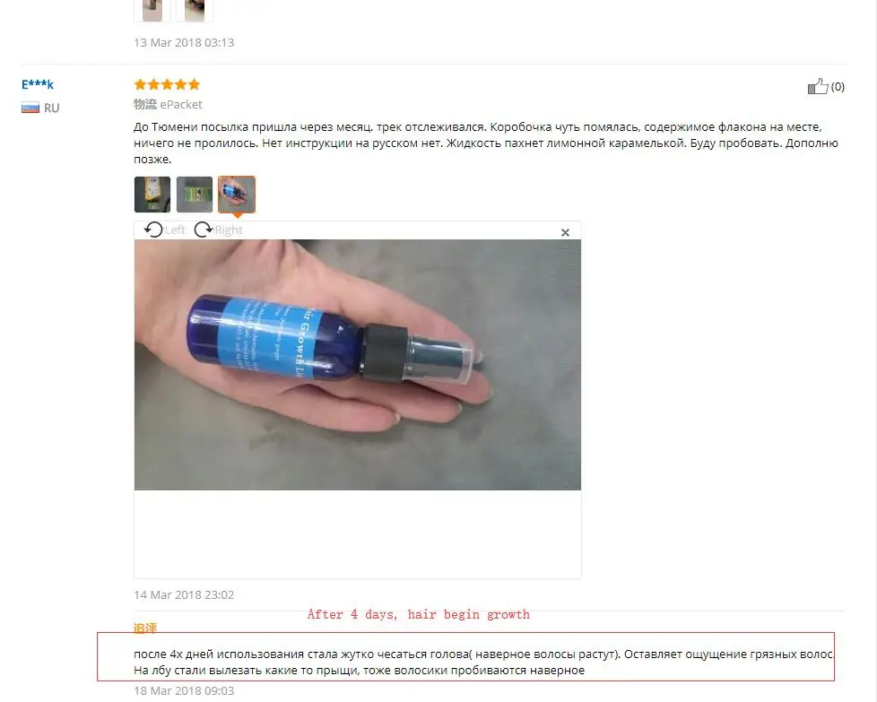 Okeny's 20 мл/30 мл Yuda Pilatory стоп выпадение волос быстрый рост волос для мужчин и женщин эфирное масло для роста волос Восстановление роста