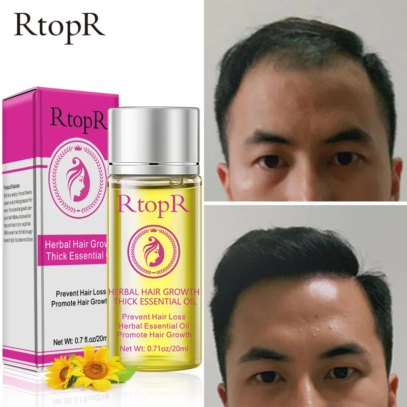 Травяной рост волос от выпадения жидкость способствует густому ускоренный