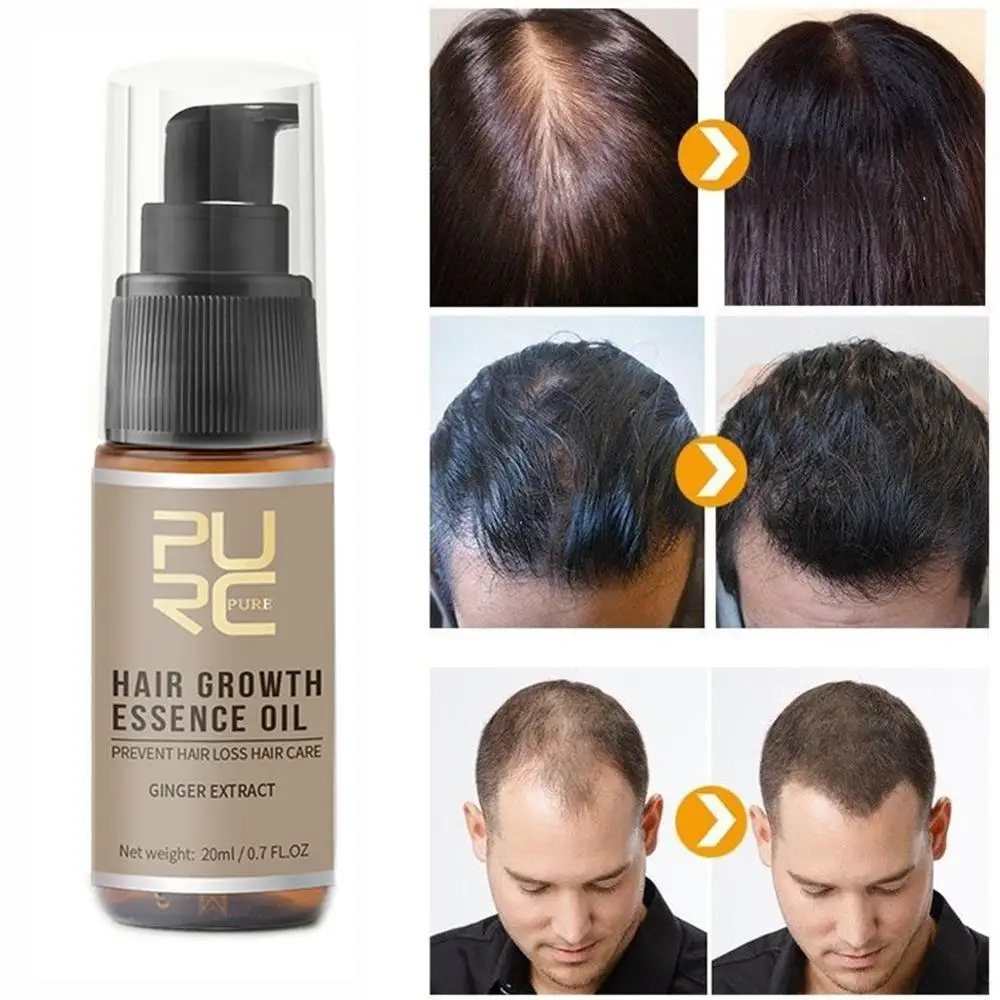 Эссенция для быстрого роста волос 20 мл масло выпадения средство ухода за